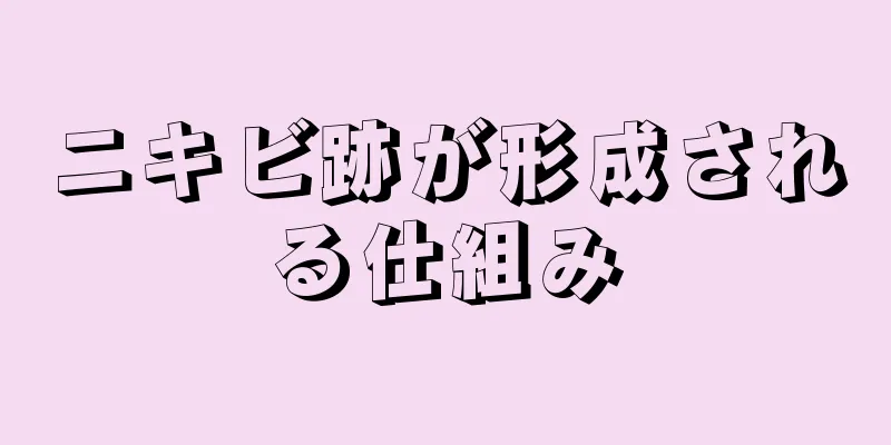 ニキビ跡が形成される仕組み