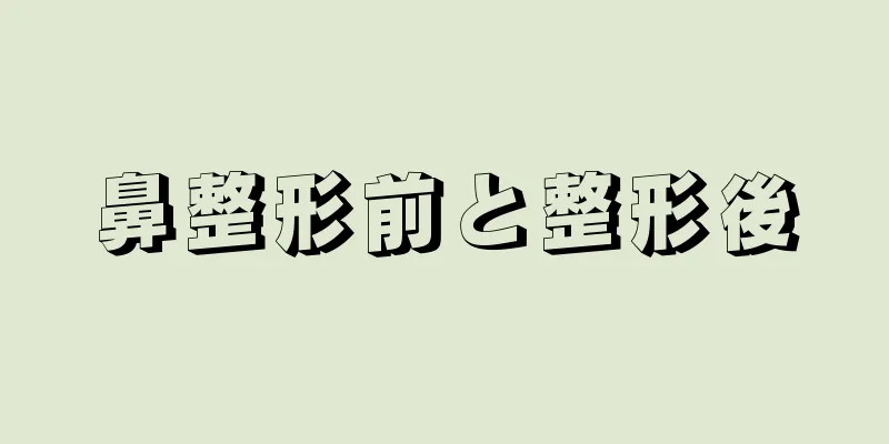 鼻整形前と整形後