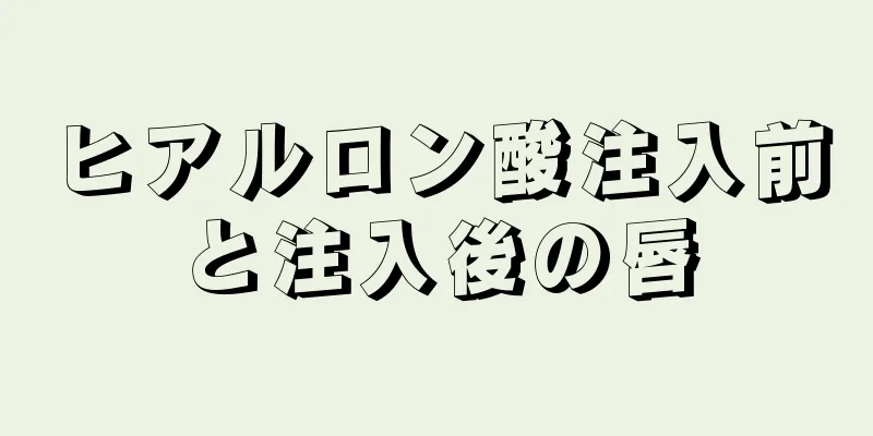 ヒアルロン酸注入前と注入後の唇
