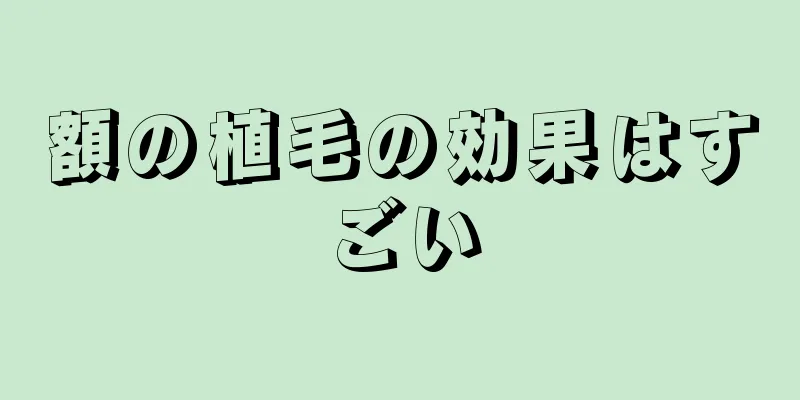 額の植毛の効果はすごい