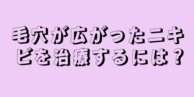 毛穴が広がったニキビを治療するには？