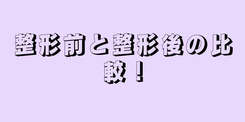 整形前と整形後の比較！